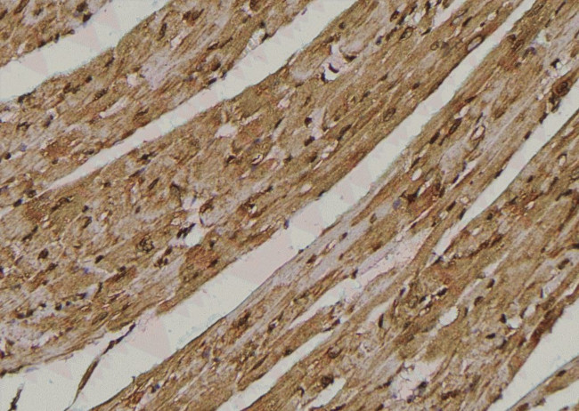 Phospho-TAK1 (Ser192) Antibody in Immunohistochemistry (Paraffin) (IHC (P))