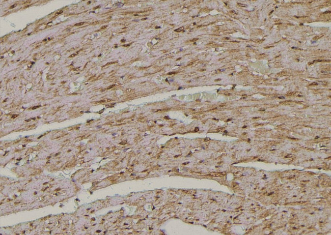 Phospho-TAK1 (Ser192) Antibody in Immunohistochemistry (Paraffin) (IHC (P))