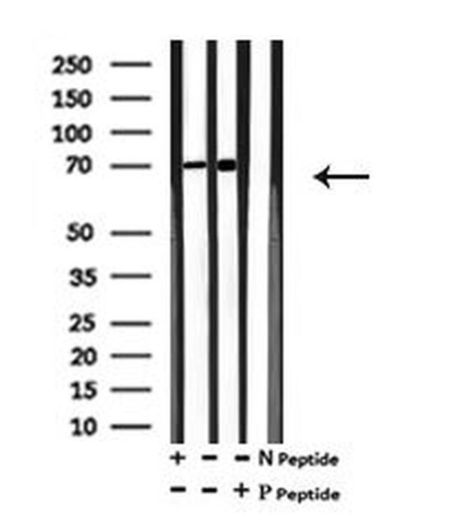 Phospho-TAK1 (Ser192) Antibody in Western Blot (WB)