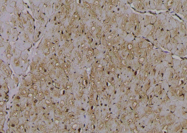 Phospho-RIP2 (Ser531) Antibody in Immunohistochemistry (Paraffin) (IHC (P))