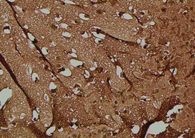 Phospho-RIP2 (Tyr381) Antibody in Immunohistochemistry (Paraffin) (IHC (P))