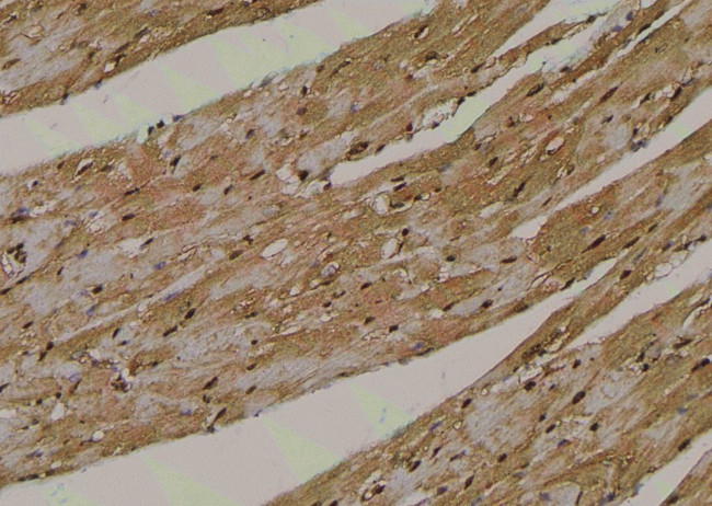 Phospho-RIP2 (Tyr381) Antibody in Immunohistochemistry (Paraffin) (IHC (P))