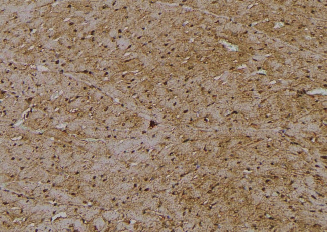 Phospho-RIP2 (Tyr381) Antibody in Immunohistochemistry (Paraffin) (IHC (P))