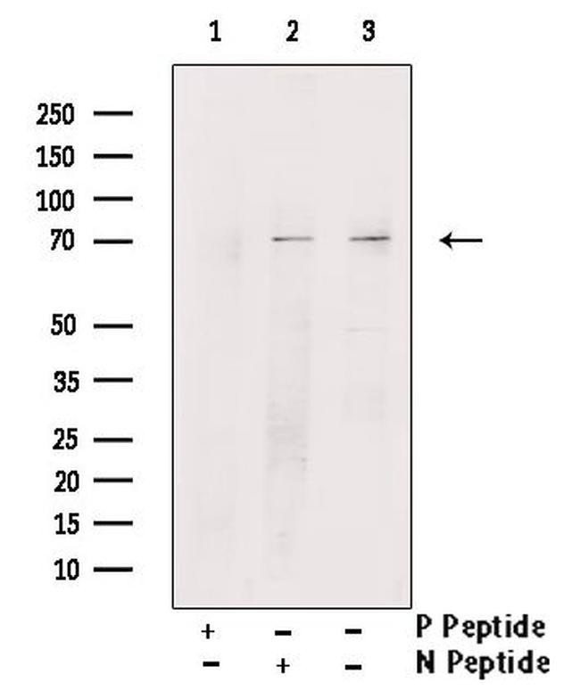 Phospho-RIP2 (Tyr381) Antibody in Western Blot (WB)