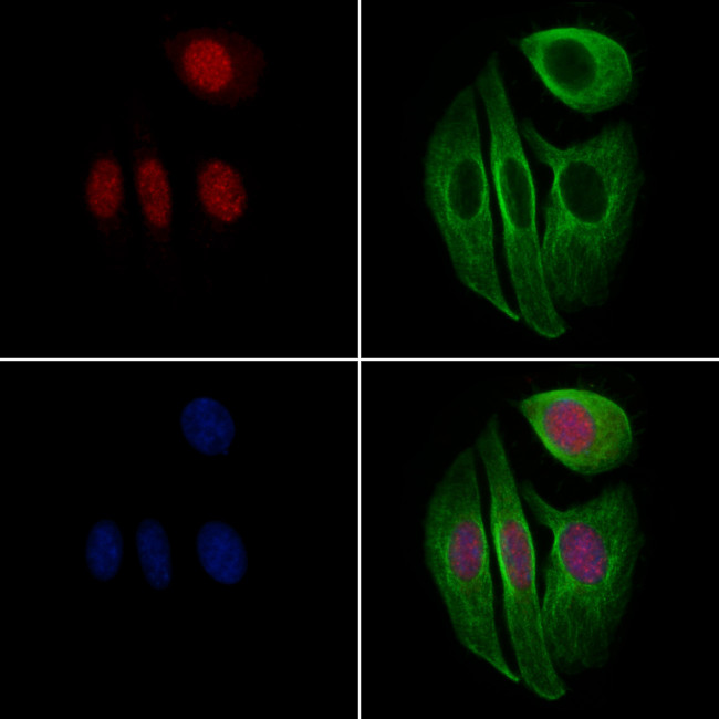 Phospho-FOXO3A (Ser284) Antibody in Immunocytochemistry (ICC/IF)