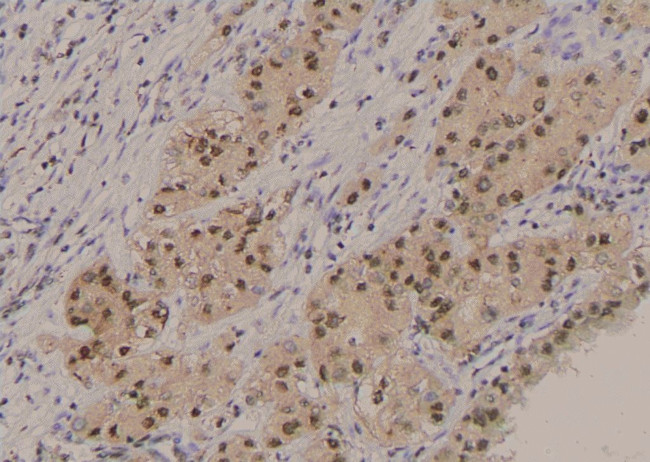 Phospho-FOXO3A (Ser284) Antibody in Immunohistochemistry (Paraffin) (IHC (P))