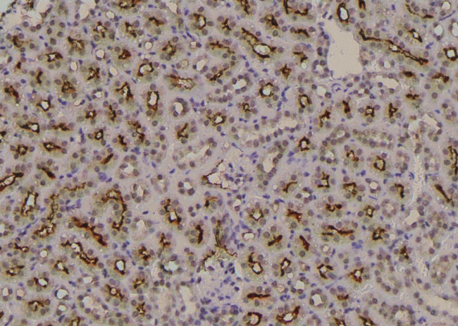 Phospho-FOXO3A (Ser284) Antibody in Immunohistochemistry (Paraffin) (IHC (P))