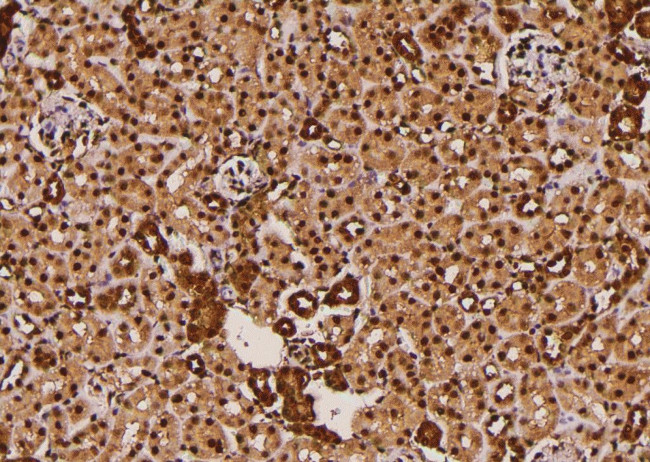 Phospho-FoxO3a (Ser644) Antibody in Immunohistochemistry (Paraffin) (IHC (P))