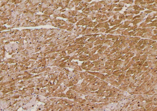 Phospho-FoxO3a (Ser644) Antibody in Immunohistochemistry (Paraffin) (IHC (P))