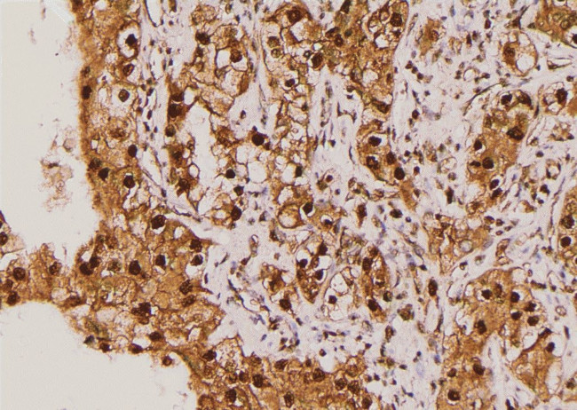 Phospho-LAT (Tyr45) Antibody in Immunohistochemistry (Paraffin) (IHC (P))