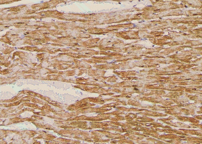 Phospho-LAT (Tyr45) Antibody in Immunohistochemistry (Paraffin) (IHC (P))