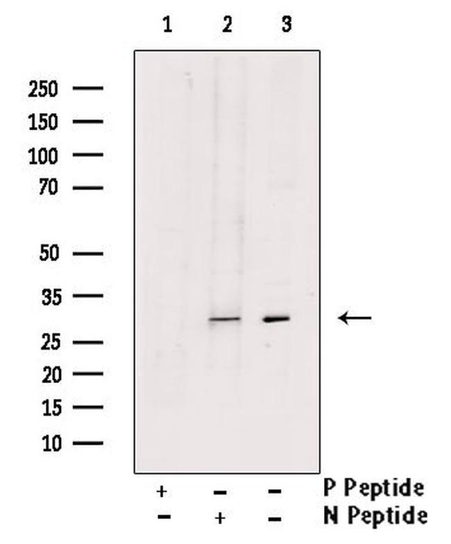 Phospho-LAT (Tyr45) Antibody in Western Blot (WB)