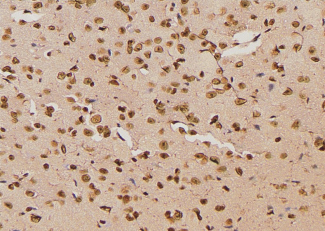 Phospho-LAT (Ser84) Antibody in Immunohistochemistry (Paraffin) (IHC (P))