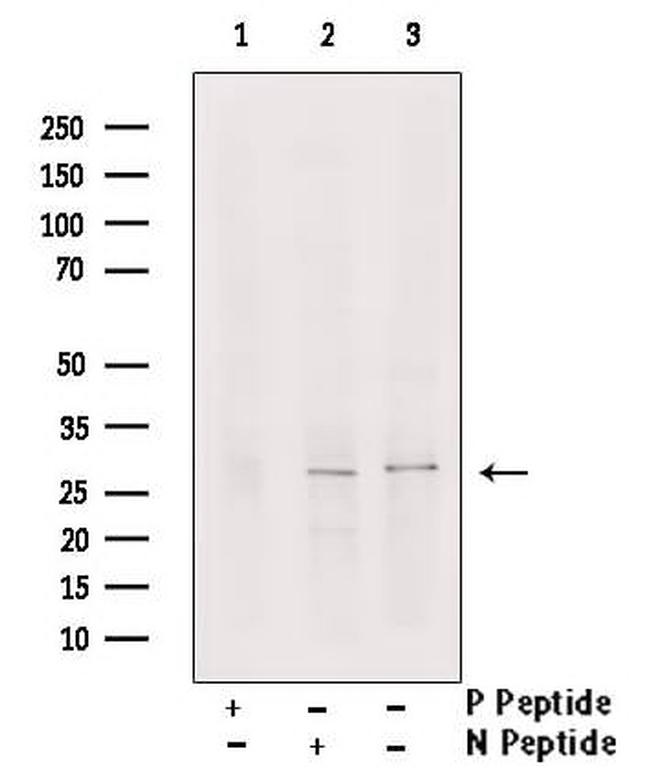 Phospho-LAT (Ser84) Antibody in Western Blot (WB)