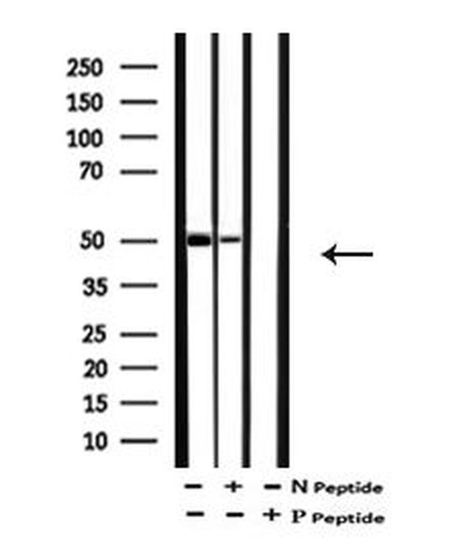 Phospho-Doublecortin (Ser332) Antibody in Western Blot (WB)