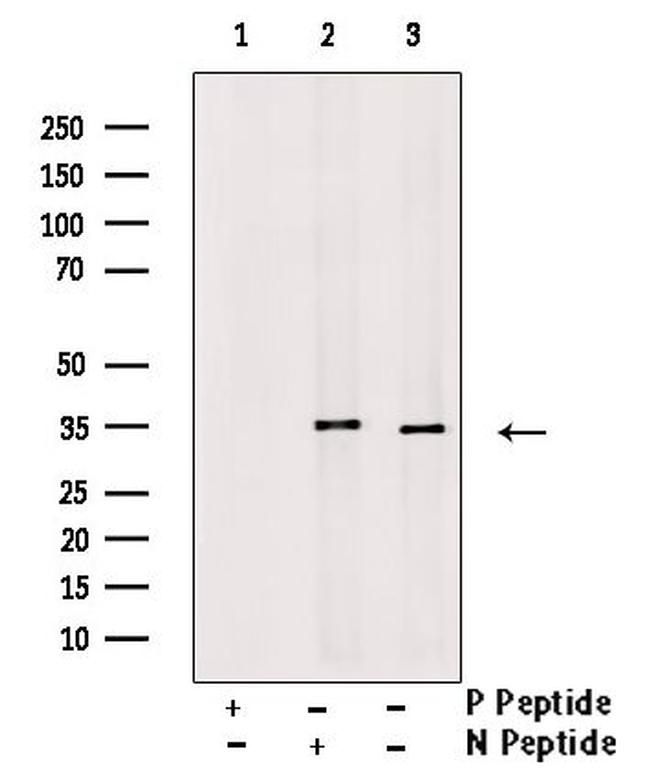 Phospho-SGTA (Ser301) Antibody in Western Blot (WB)