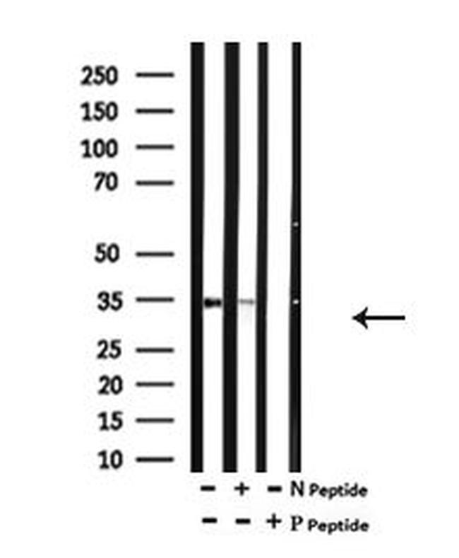 Phospho-SGTA (Ser301) Antibody in Western Blot (WB)