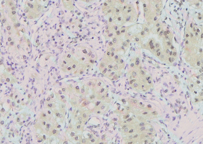 Phospho-KIF1B (Ser1057) Antibody in Immunohistochemistry (Paraffin) (IHC (P))