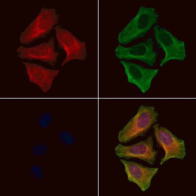 Phospho-AS160 (Ser341) Antibody in Immunocytochemistry (ICC/IF)