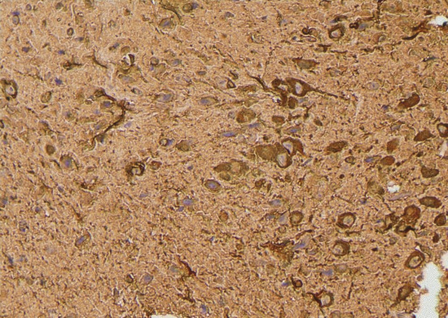 Phospho-AS160 (Ser341) Antibody in Immunohistochemistry (Paraffin) (IHC (P))