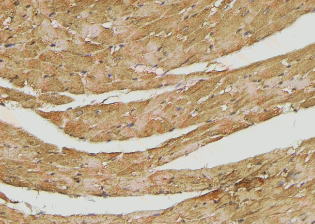 Phospho-AS160 (Ser341) Antibody in Immunohistochemistry (Paraffin) (IHC (P))