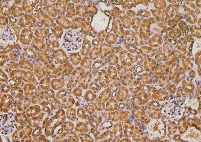 Phospho-AS160 (Ser341) Antibody in Immunohistochemistry (Paraffin) (IHC (P))