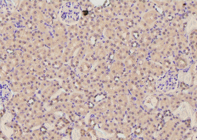 Phospho-AS160 (Ser570) Antibody in Immunohistochemistry (Paraffin) (IHC (P))