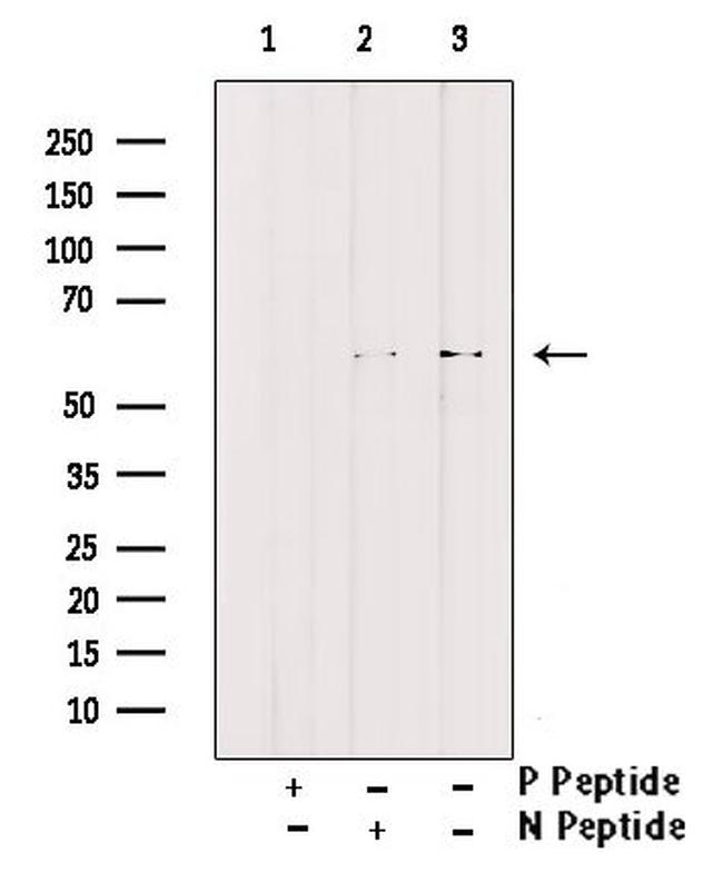 Phospho-HBP1 (Ser380) Antibody in Western Blot (WB)