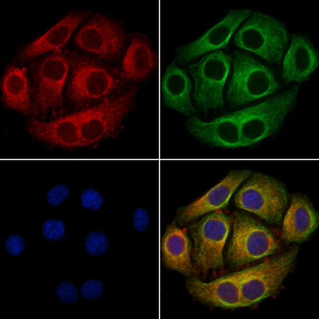 Phospho-delta Catenin (Tyr248) Antibody in Immunocytochemistry (ICC/IF)