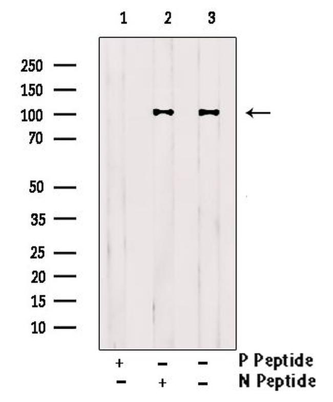 Phospho-delta Catenin (Tyr248) Antibody in Western Blot (WB)