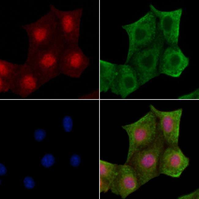 Phospho-delta Catenin (Tyr280) Antibody in Immunocytochemistry (ICC/IF)