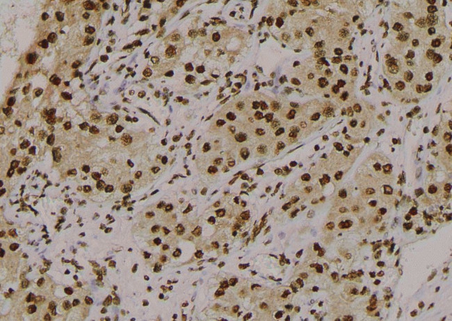 Phospho-delta Catenin (Tyr280) Antibody in Immunohistochemistry (Paraffin) (IHC (P))