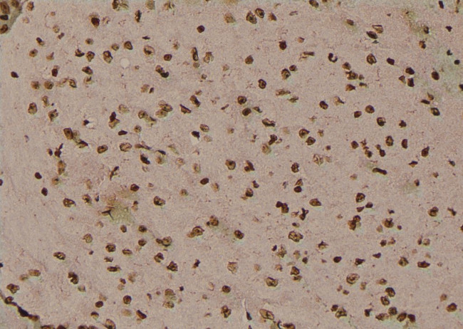 Phospho-delta Catenin (Tyr280) Antibody in Immunohistochemistry (Paraffin) (IHC (P))