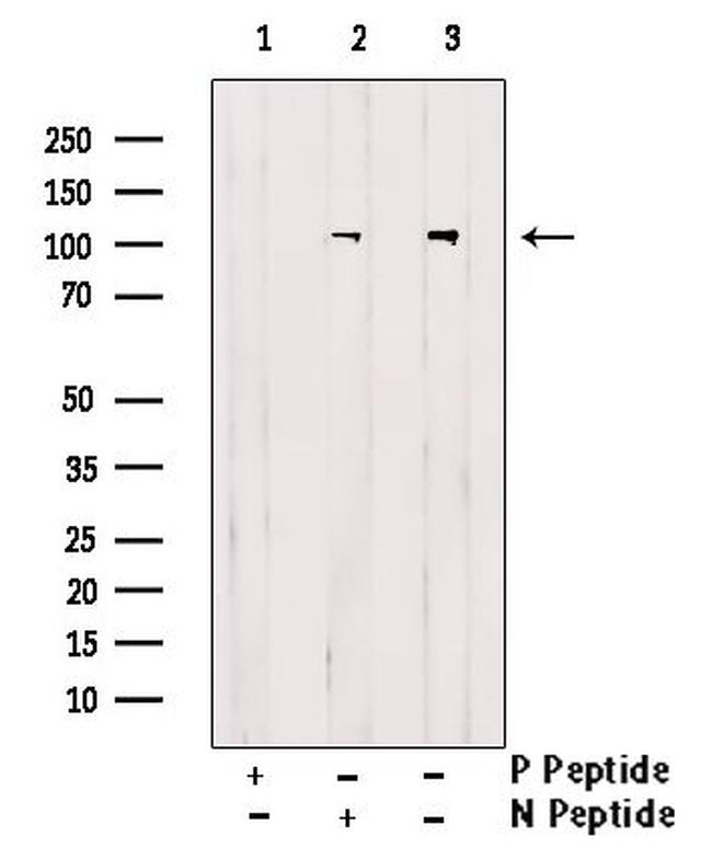 Phospho-delta Catenin (Tyr280) Antibody in Western Blot (WB)