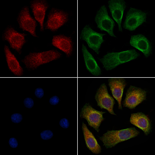 Phospho-delta Catenin (Tyr96) Antibody in Immunocytochemistry (ICC/IF)