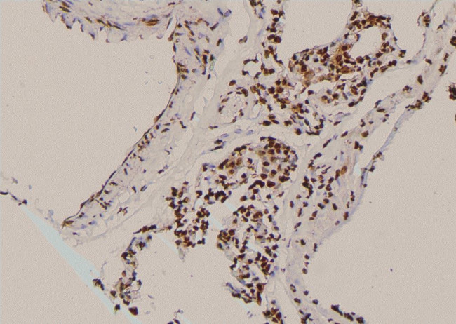 Phospho-delta Catenin (Tyr96) Antibody in Immunohistochemistry (Paraffin) (IHC (P))