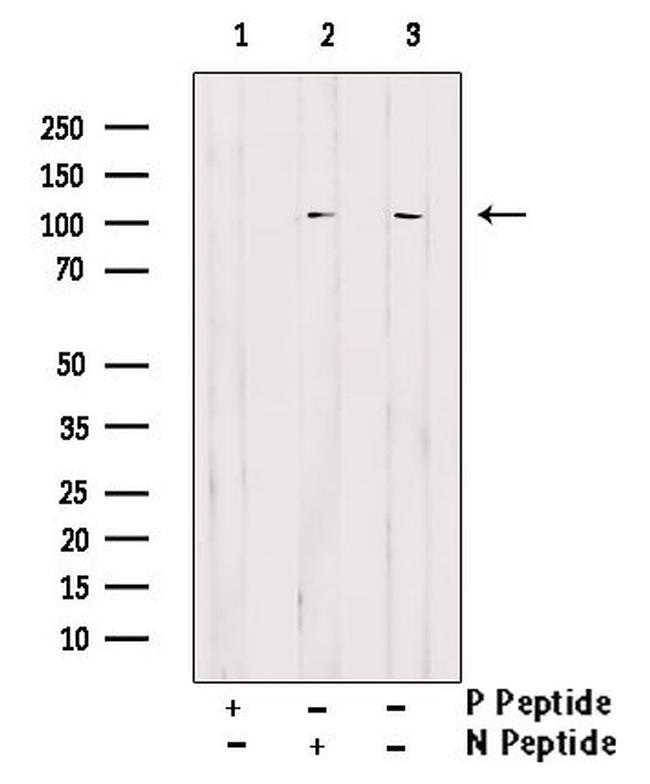 Phospho-delta Catenin (Tyr96) Antibody in Western Blot (WB)