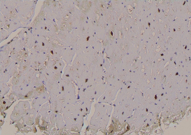 Phospho-PFKFB2 (Ser32) Antibody in Immunohistochemistry (Paraffin) (IHC (P))