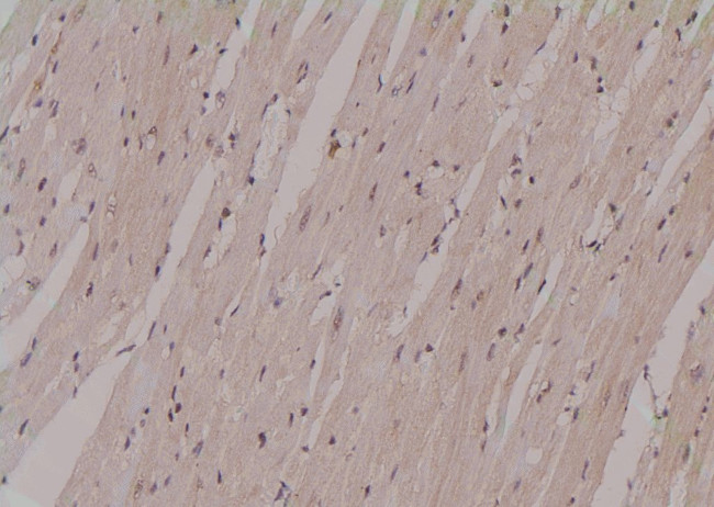 Phospho-PFKFB2 (Ser32) Antibody in Immunohistochemistry (Paraffin) (IHC (P))