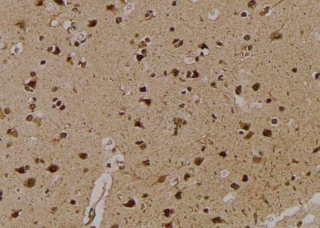 Phospho-ULK1 (Ser131) Antibody in Immunohistochemistry (Paraffin) (IHC (P))