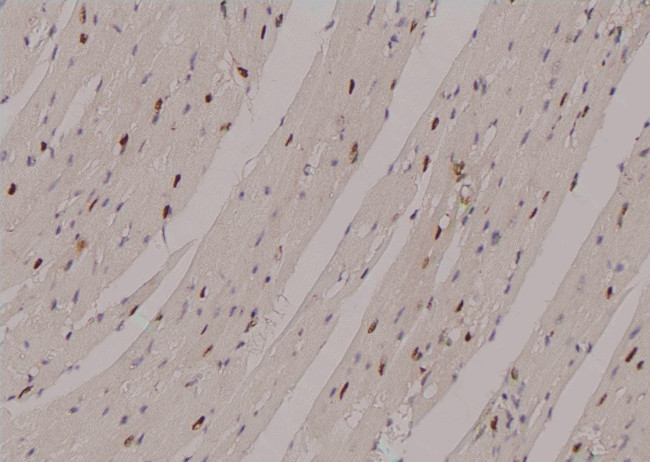 Phospho-ULK1 (Ser131) Antibody in Immunohistochemistry (Paraffin) (IHC (P))