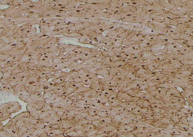 Phospho-ULK1 (Ser131) Antibody in Immunohistochemistry (Paraffin) (IHC (P))