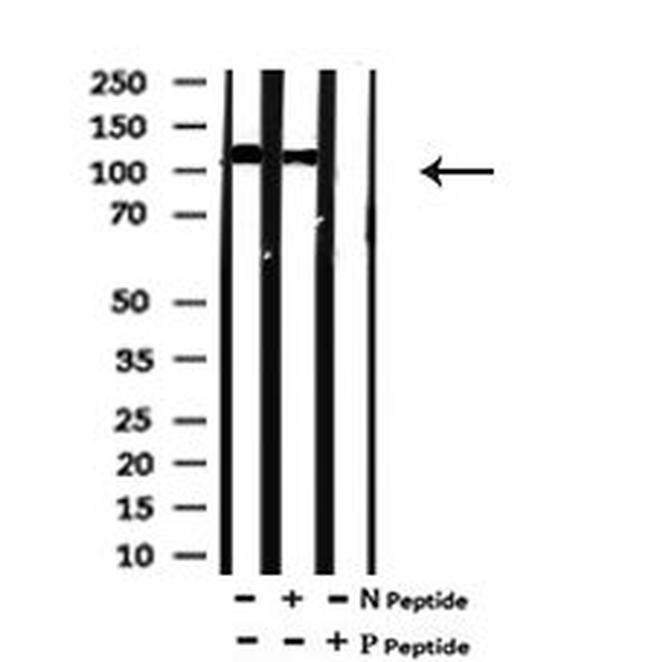 Phospho-ULK1 (Ser131) Antibody in Western Blot (WB)