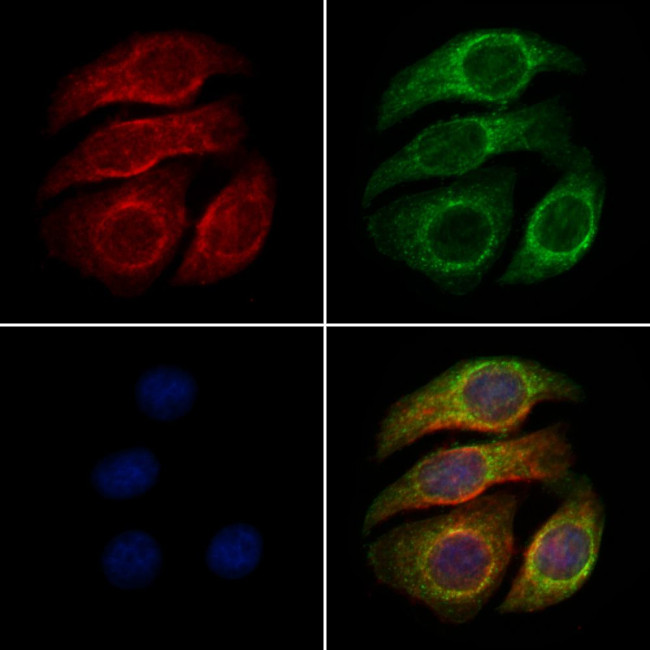 Phospho-ULK1 (Ser450) Antibody in Immunocytochemistry (ICC/IF)