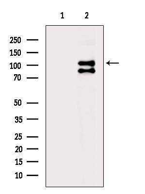 Phospho-ULK1 (Ser450) Antibody in Western Blot (WB)