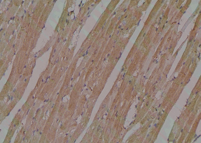 Phospho-ULK1 (Ser556) Antibody in Immunohistochemistry (Paraffin) (IHC (P))