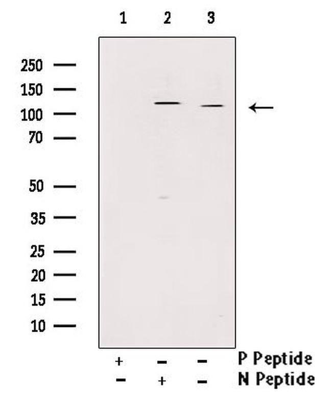 Phospho-ULK1 (Ser556) Antibody in Western Blot (WB)