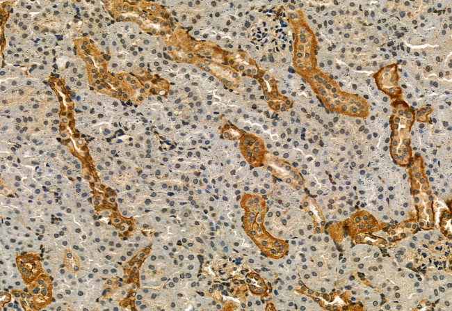 Phospho-IRE1 alpha (Ser724) Antibody in Immunohistochemistry (Paraffin) (IHC (P))