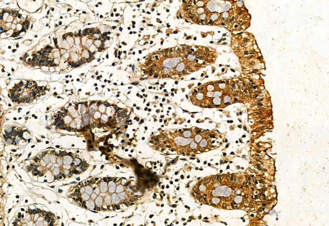 Phospho-IRE1 alpha (Ser724) Antibody in Immunohistochemistry (Paraffin) (IHC (P))