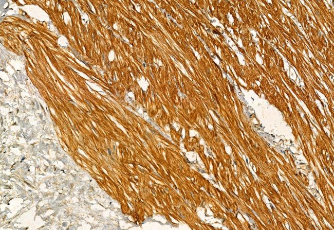 Phospho-IRE1 alpha (Ser724) Antibody in Immunohistochemistry (Paraffin) (IHC (P))